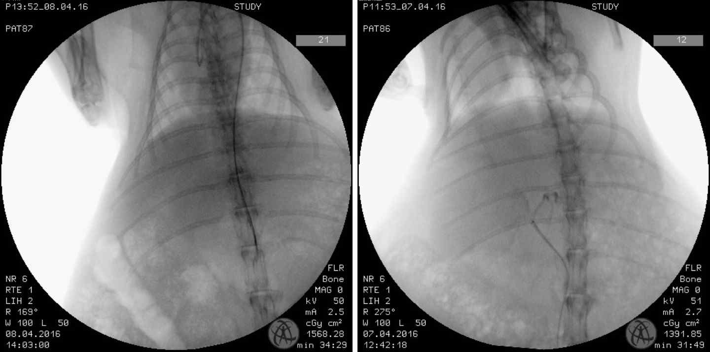 간암 토끼 모델에 대한 catheter 시술의 angiography 영상