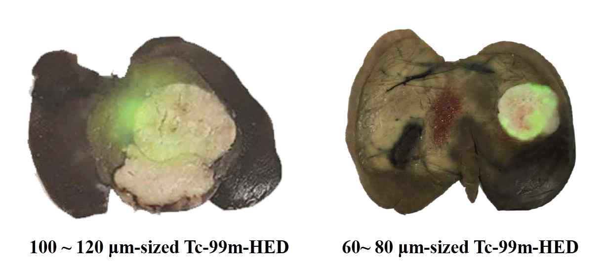 간암 토끼 모델에 대한 입자 크기별 Tc-99m-HED의 autoradiography 생체 분포 영상