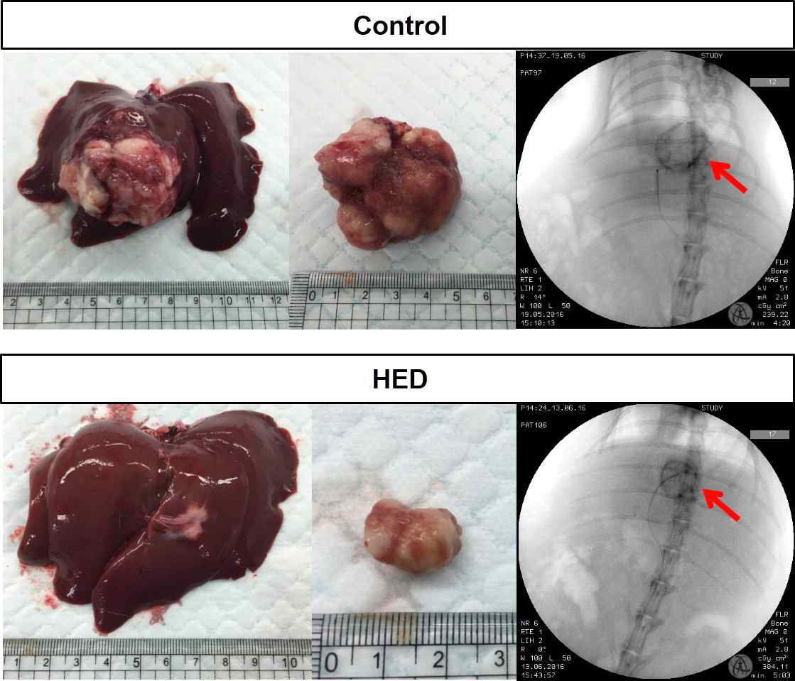 대조군과 HED 처리 2주 후 angiography 영상 (우측)과 간 적출(좌측), 분리한 종양 (중앙)의 사진