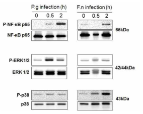 NF-kB and MAPK activation in gingival fibroblast infected with F. nucleatum or P. gingivalis