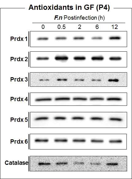 Expression of Prdxs in gingival fibroblast infected with F. nucleatum or P. gingivalis