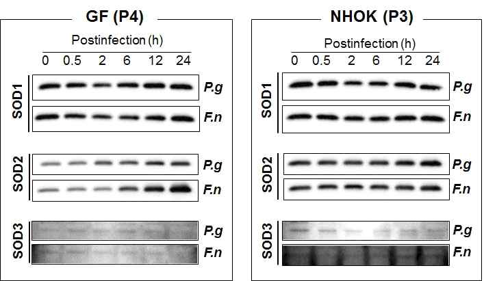 SOD1, 2, 3 expression in GFs and NHOKs after F. nucleatum or P. gingivalis infection