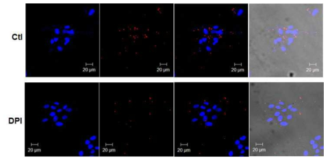 Confocal micrographs showing selective reduction of P. gingivalis (red spots) after coinfection with F. nucleatum in GFs pretreated with DPI.