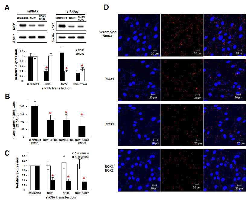 siRNA knockdown of NOX1, NOX2, or NOX1/NOX2 in GFs decreases attachment of P. gingivalis after coinfection with F. nucleatum.