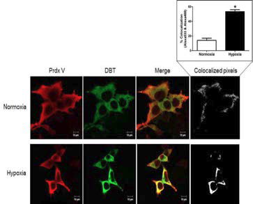 정상산소환경과 저산소환경의 HEK293세포에서 면역형광염색을 이용한 PrdxV와 DBT의 colocalization