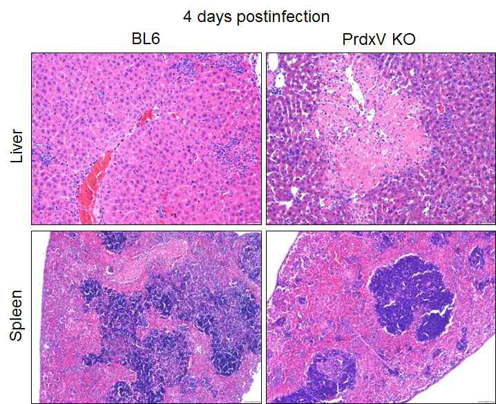 PrdxV KO 혹은 고발현된 마우스에 살모넬라 감염후 간과 비장조직의 해부학적 분석