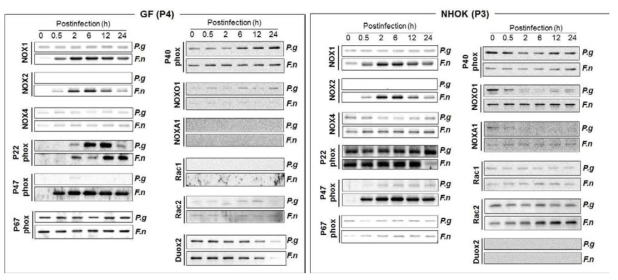 Expression of NADPH oxidase subunit in primary human oral cells during oral bacterial infection