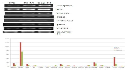 iPS를 각막상피세포배지(CEpi-M) 및 각막윤부세포 배지(PI)에 14일간 배양한 후 RT-PCR(상)과 realtime PCR (하) 시행함.