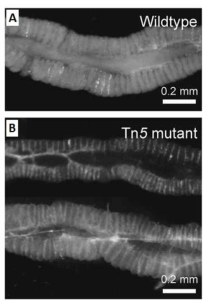 Transposon Burkholderia 변이 균주가 감염된 곤충숙주의 M4 morphology.