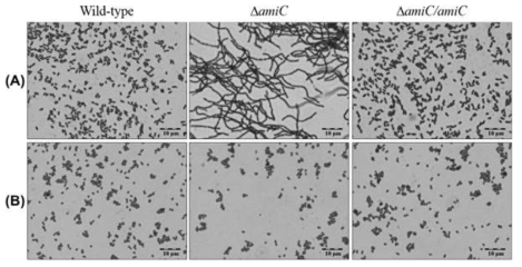 (A) 영양이 풍부한 배지와 (B) 영양이 부족한 배지에서 배양한 △amiC Burkholderia 변이 균주의 cell morphology