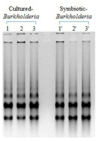 실험실에서 배양한 Burkholderia와 장내 공생Burkholderia의 total RNA 추출.