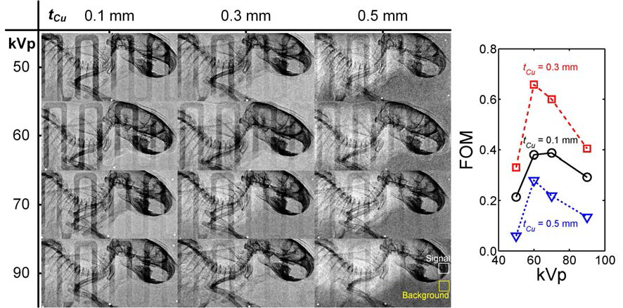 다양한 관전압 조건과 추가 감쇠 필터 두께 조건하에서 획득한 단일조사 이중에너지 골조직 강조 영상과 이에 대한 FOM