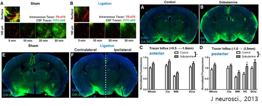 뇌혈류량을 저하시킨 모델의 글림파틱 시스템 변화