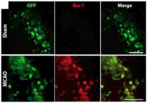 이광자 현미경을 사용, 뇌경색이 유도된 뇌 (MCAO)에서 관찰된 미세아교세포 특이적 시그널 (Iba-1). 정상적인 뇌 (Sham)에서는 blood-brain-barrier 때문에 이러한 시그널이 관찰 되 지 않음.