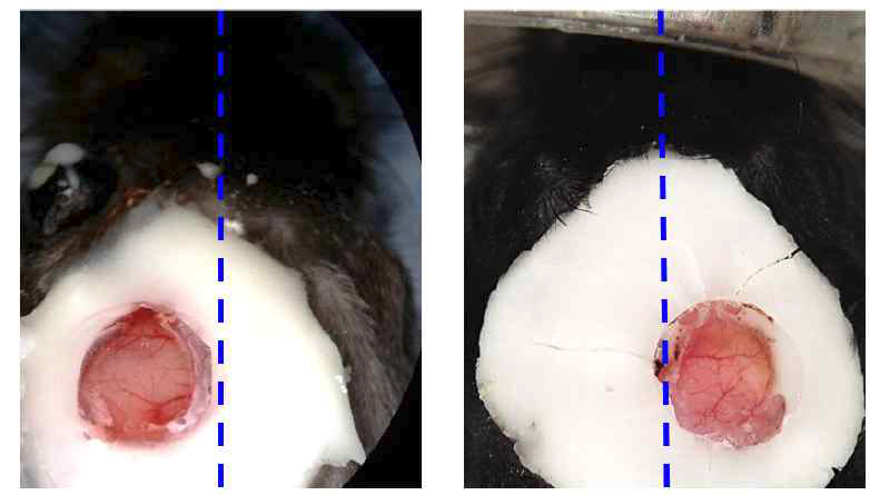 뇌경색이 유도된 부분(왼쪽) 또는 그 반대편(오른 쪽)에 확립 한 intracranial window chamber의 사진.