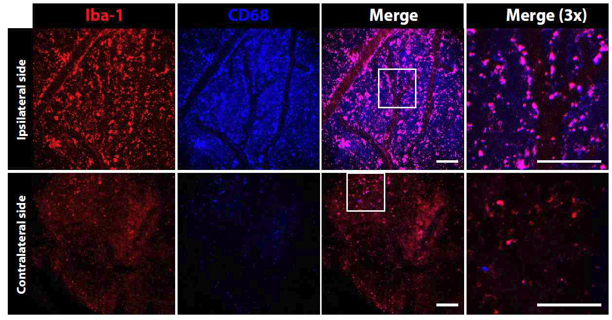 뇌경색이 유도된 부분 (위, Ipsilateral side) 또는 반대부분 (아래, contralateral side)에 window chamber를 확립 한 후 촬영한 이광자 현미경 이미지. 뇌경색이 유도된 부분에 집중적으로 활성화 미세아 교세포가 존재 하는 것이 관찰되었음.