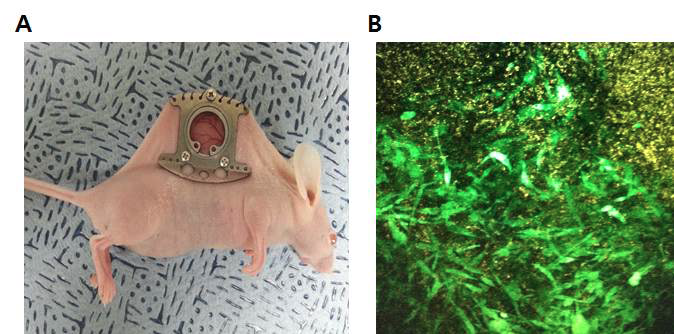 마우스에 dorsal window chamber를 확립한 모습(A)과 그 안에 이식된 GFP를 발현하는 암세포주의 성장을 이광자 현미경으로 촬영한 사진 (B).