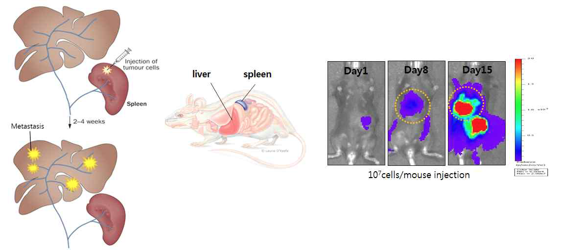 비장에 암세포를 주사 한 후 간으로 전이 되는 간전이 모델.