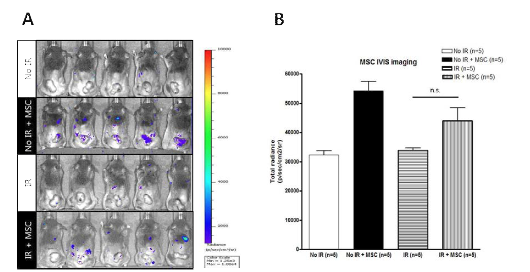 마우스 피하이식 종양에 방사선 치료 후 중간엽 줄기세포를 1회 주입하여 IVIS로 촬영한 결과(A)와 luciferase 신호를 수치화한 그래프(B).
