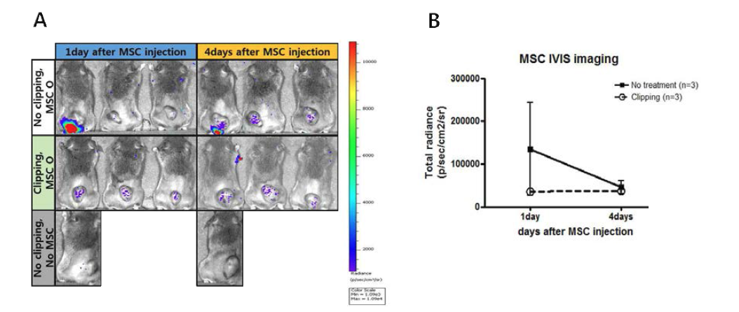 마우스 피하이식 종양에 clipping을 하여 저산소증을 유도한 후 중간엽 줄기세포를 주입하여 IVIS로 촬영한 결과(A)와 luciferase 신호를 수치화한 그래프(B).