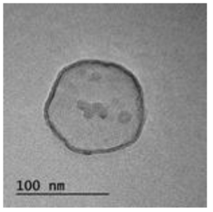 TEM을 통한 TCA가 결합된 liposome의 모양 분석 결과
