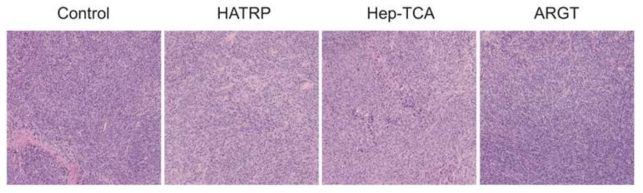 H&E staining 이미지를 통한 조직(간) 검사 결과 이미지