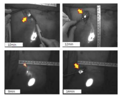 이미징 시스템을 활용한 intraoperative surgery 시연 (서울대 의대 공동연구)