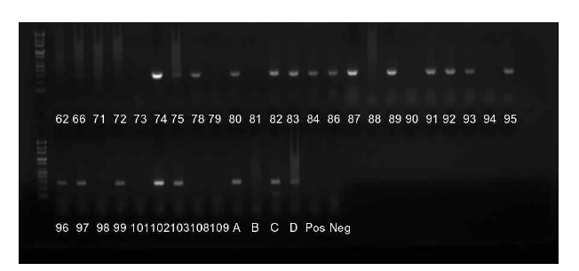 GII-F1M-GII-F3M/GII-R1M primer set을 활용한 GII nested RT-PCR.