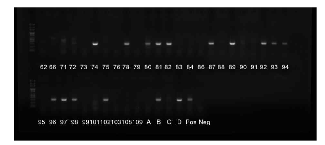 COG2F-G2SKF/G2SKR primer set을 활용한 GII nested RT-PCR.