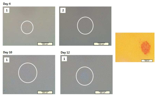 인간 iPSCs의 4, 10, 12일의 morphology를 담은 현미경 사진과 AP staining 사진