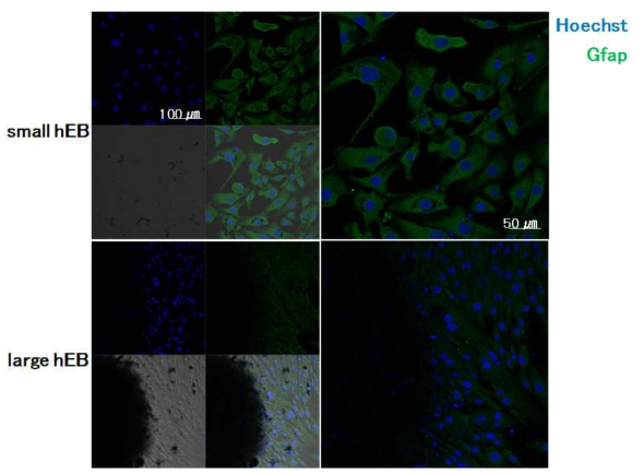 지름 300 um를 기준으로 작고 큰 3차원 줄기세포에서 외배엽성 분화 마커인 Gfap의 발현 레벨을 비교 분석한 2차 면역 염색법 공초점형광현미경(CLSM) 사진
