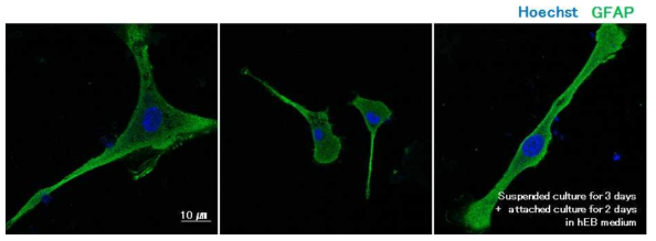 신경분화마커의 2차 면역 염색법을 통해 탐지된 3차원 줄기세포 구성 세포의 모습 공초점형광현미경 사진