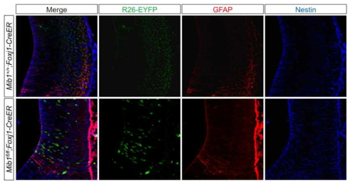 Mib1이 제거된 ependyme을 포함한 대뇌 발달.