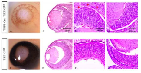 망막색소상피세포에서 Tsg101이 제거된 생쥐 안구의 형태적 특징.