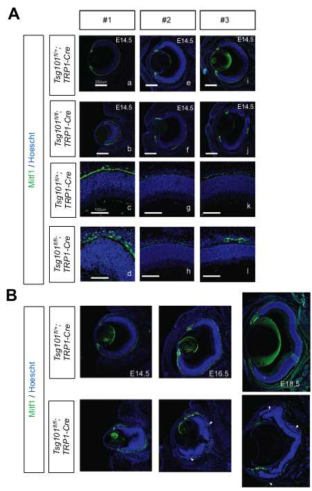 Tsg101fl/fl;TRP1-Cre 생쥐 안구 내 망막색소상피세포 분포.