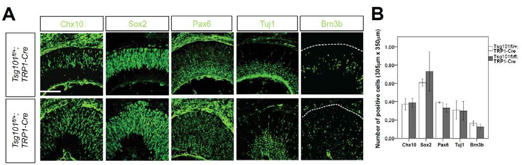 Tsg101fl/fl;TRP1-Cre 생쥐 망막 내 세포 구성의 특징