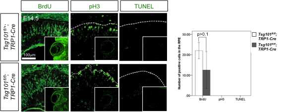 Tsg101fl/fl;TRP1-Cre 생쥐 망막 내 세포 분열과 사멸 특징