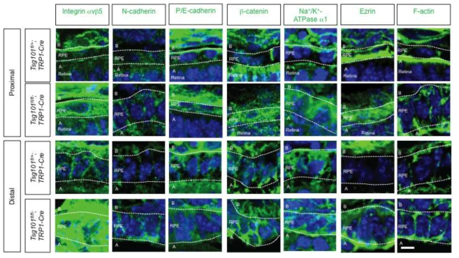 Tsg101 결핍 생쥐 망막색소상피 내 세포 극성 및 접합 유지 단백질의 분포 변화.