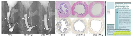 시롤리무스 코팅 PLLA 스텐트의 효능결과 및 SCI 게재된 논문