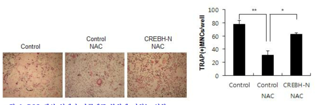 ROS 생성 억제가 파골세포 분화에 미치는 영향