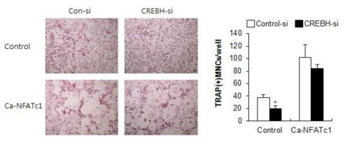 파골세포에서 NFATc1의 조절을 통한 CREBH의 작용