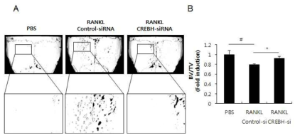 CREBH-siRNA가 RANKL에 의한 골 손실에 미치는 영향