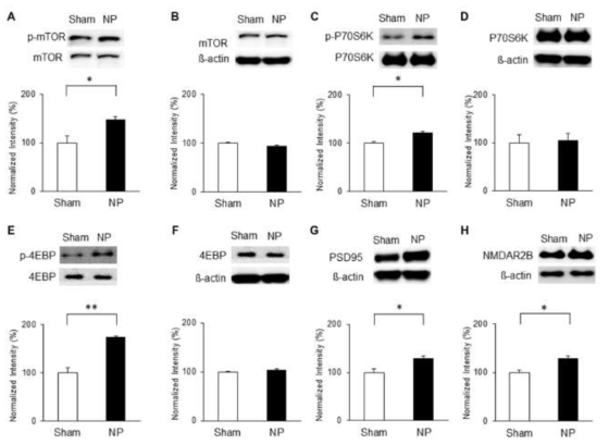 Rapamycin 투여 이후 IC에서 mTOR 및 하위 substrate의 발현량 확인 (A-B) mTOR와 mTOR의 활성형인 p-mTOR 비교 (C-D) P70S6K와 p-P70S6K 발현량 비교 (E-F) 4EBP와 p-4EBP 발현량 비교 (G-F) PSD95와 NMDAR2B의 활성도 비교