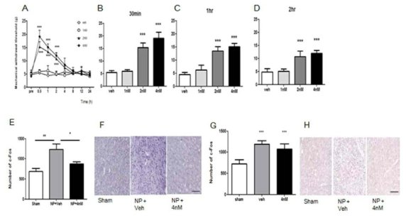 통증모델의 IC에 FAAH inhibitor 주입 후 통증행동 관찰 및 ACC와 IC에서 조직의 변화 관찰.