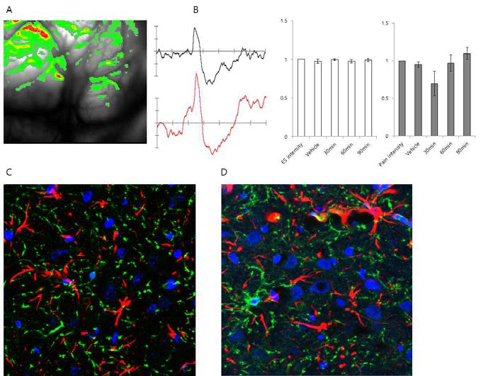 Insular cortex에서의 활성화 분석 및 조직의 synaptic structure 분석.