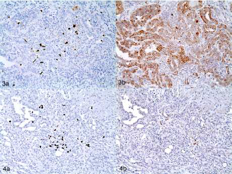 Fig 3a: 정상 개체에서의 macrophage 발현, 3b: 정상 개체에서의 3a와 동일 부위에서의 IL-6 발 현 Fig 4a: 비만개체에서의 macrophage 발현, 4b: 비만 개체에서의 4a와 동일 부위에서의 IL-6 발 현