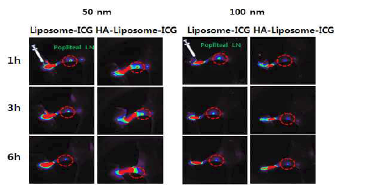 HA-lipsome의 전이림프절 탐색능 평가