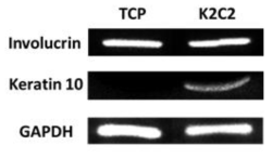세포배양접시와 K2C2에 10일간 배양한 각질세포(HaCaT)의 중합효소 연쇄반응(PCR) 시험 결과; Involucrin: 각질세포 전기 분화마커, Keratin 10: 각질세포 후기 분화마커, GAPDH: 세포 수 대조 비교 마커.