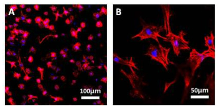 GelMA 하이드로젤에 10일간 배양한 섬유아세포의 형광염색 이미지. (A) 저배율, (B) 고배율.