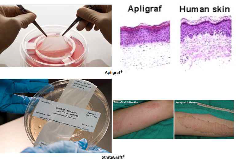 상용화된 이중층 피부재생용 지지체 (Apligraf®, StrataGraft®) 및 조직재생 관련 사진.